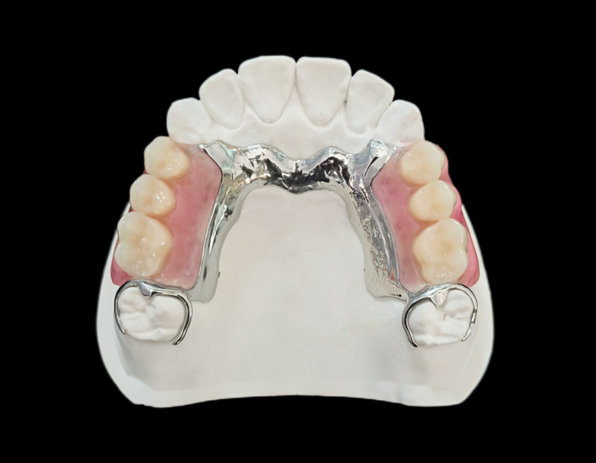 Chrome Cast Partial Denture
